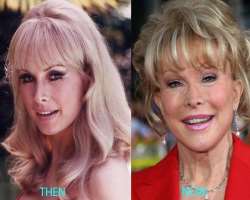 Barbara Eden before surgery